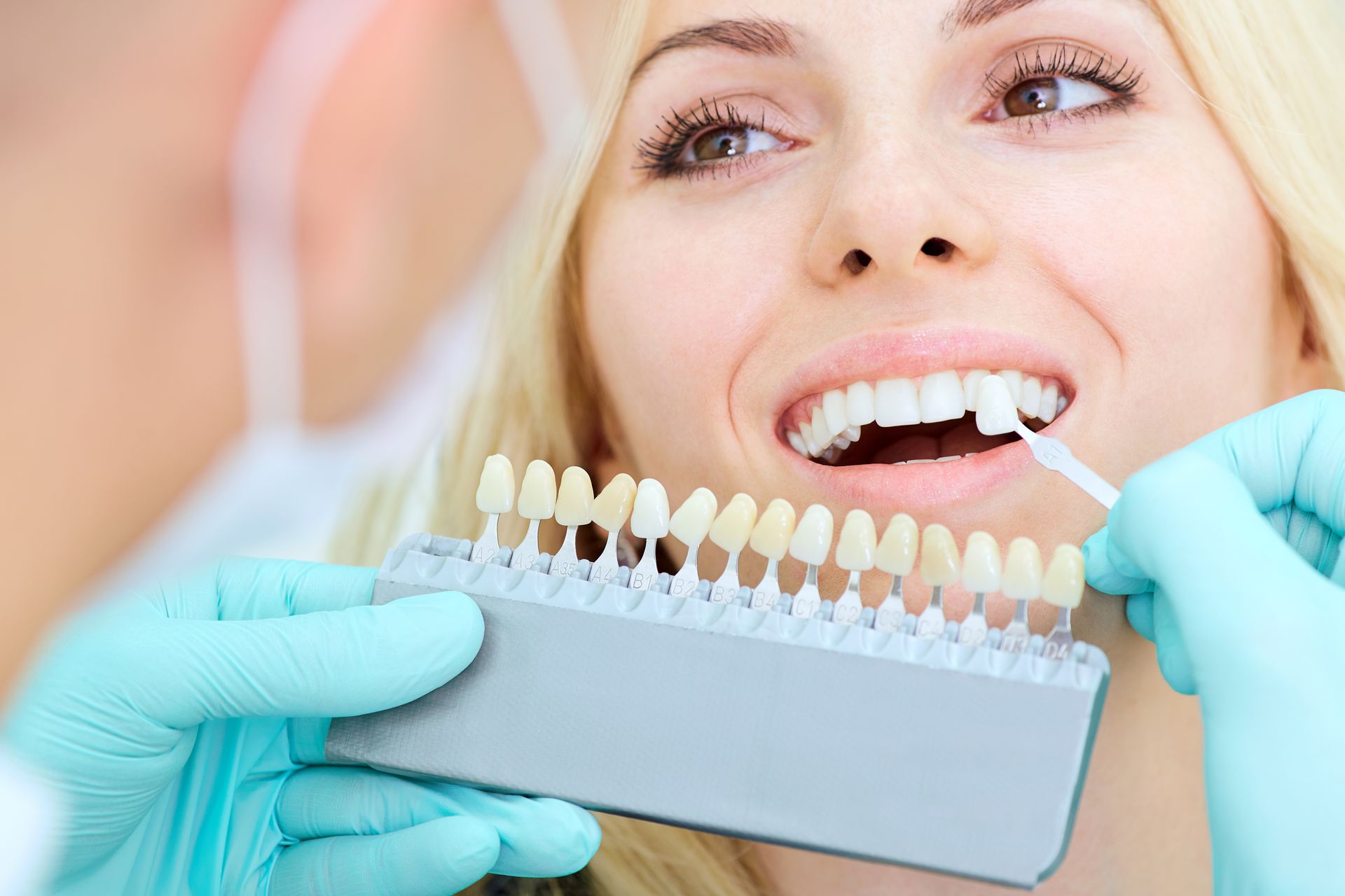 Las dentales, ¿qué función tienen? - Impladent
